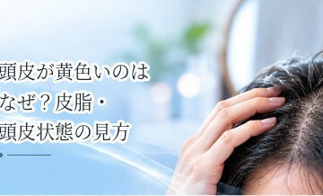 頭皮が黄色いのはなぜ？皮脂・頭皮状態の見方を解説