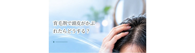 育毛剤で頭皮がかぶれたらどうする？接触皮膚炎の可能性と対処法