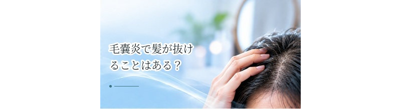 毛嚢炎で髪が抜けることはある？頭皮の炎症と脱毛の関係