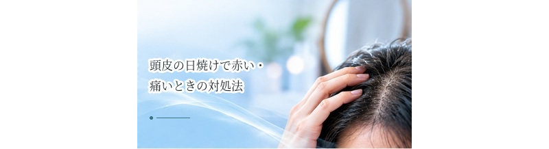 頭皮の日焼けで赤い・痛いときの対処法｜冷却と受診の目安