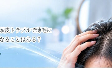 頭皮トラブルで薄毛になることはある？炎症と抜け毛の関係を解説