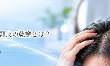頭皮の乾癬とは？フケに似た症状・赤み・受診の目安を解説