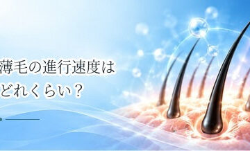 薄毛の進行速度はどれくらい？急に進む場合とゆっくり進む場合の違い