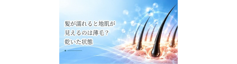 髪が濡れると地肌が見えるのは薄毛？乾いた状態との違いを解説