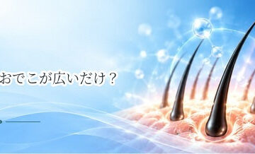 おでこが広いだけ？薄毛による生え際後退との見分け方