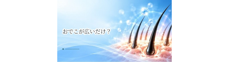 おでこが広いだけ？薄毛による生え際後退との見分け方