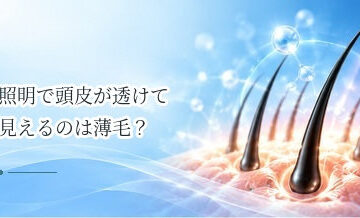 照明で頭皮が透けて見えるのは薄毛？写真で確認するときの注意点
