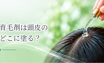 育毛剤は頭皮のどこに塗る？薄毛部分だけでよいかを解説